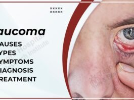 Glaucoma Symptoms
