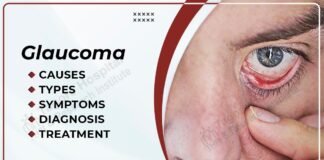 Glaucoma Symptoms