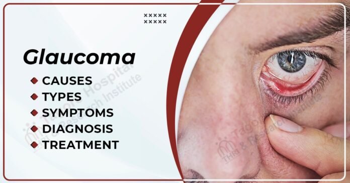 Glaucoma Symptoms Glaucoma Symptoms